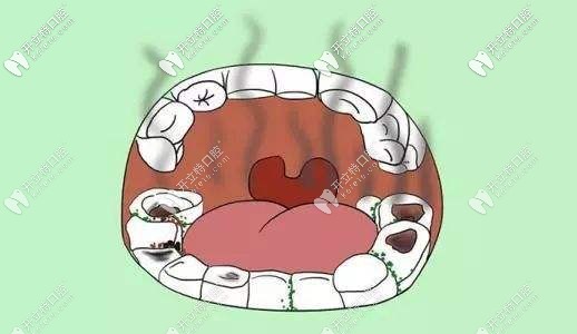 蛀虫塞牙怎么办