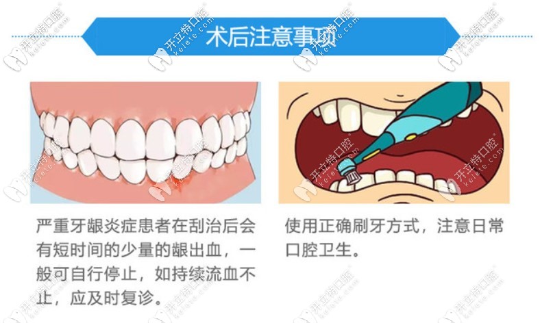 龈下刮治的副作用