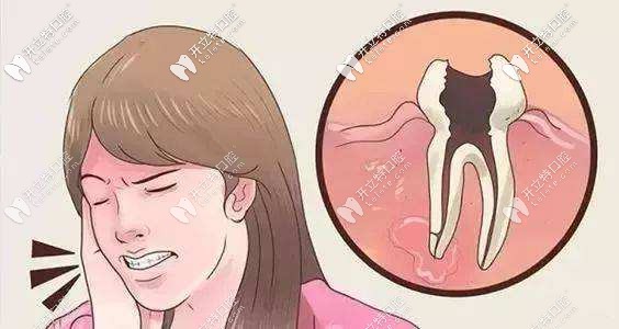 牙疼起来真要命呀 牙疼起来真要命呀