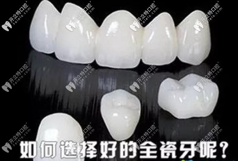 全瓷牙如何选择 全瓷牙如何选择