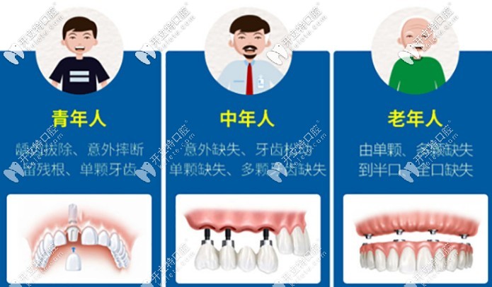 百康特种植体的价格是多少