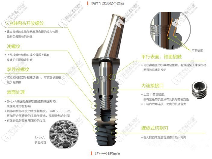 百康特种植体怎么样