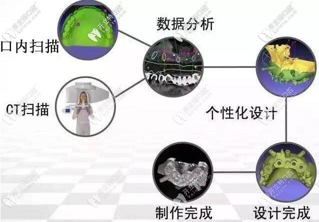 3D数字化导板种植牙不翻瓣