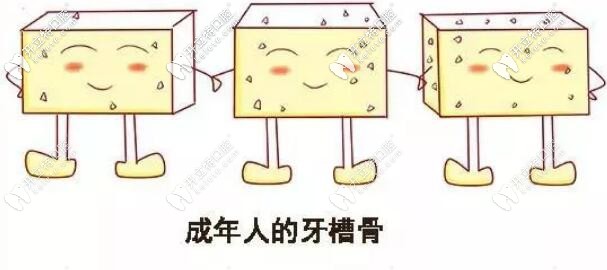 成人牙齿矫正效果不打折 成人牙齿矫正效果不打折