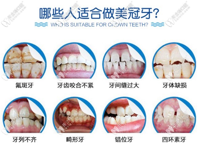 看看您的牙齿是哪种情况呢