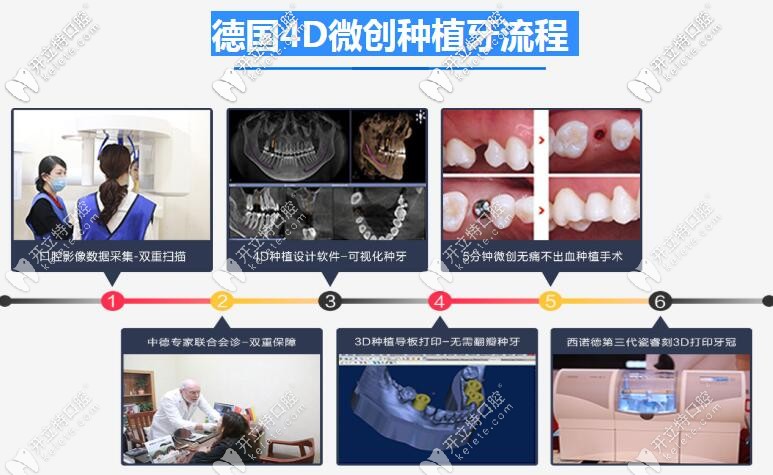 广州德系口腔德国4D微创种植牙流程