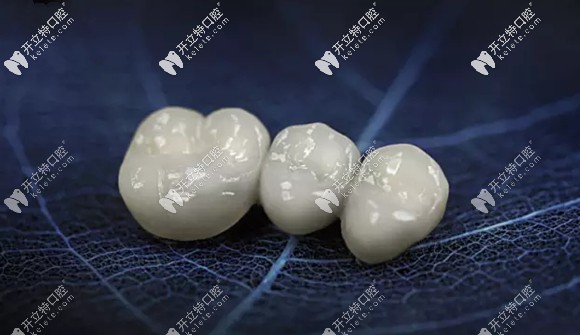 做一颗德国的阿曼吉尔巴赫氧化锆全瓷牙花了3000元值吗