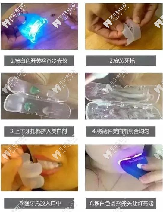 很多美牙仪都是三无产品 很多美牙仪都是三无产品