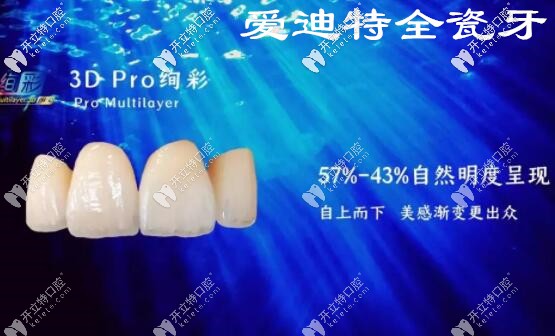 爱迪特全瓷牙 爱迪特全瓷牙