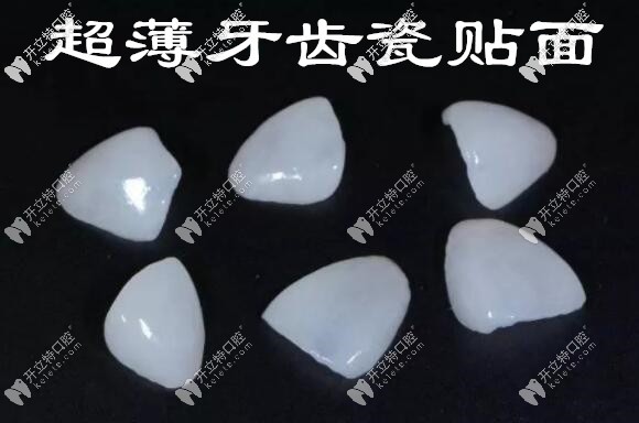 牙齿贴面会导致凸嘴吗 牙齿贴面会导致凸嘴吗
