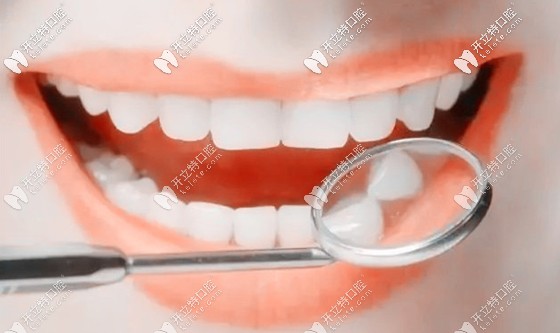 对照标准的牙齿咬合图就可判断自己到底需不需要整牙哦