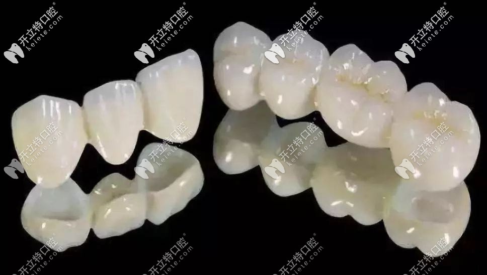柏乐口腔全瓷牙冠 柏乐口腔全瓷牙冠
