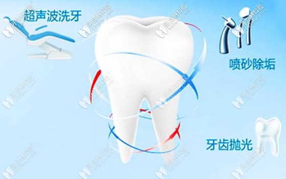 洗牙加喷砂抛光是口腔保健的基本 洗牙加喷砂抛光是口腔保健的基本