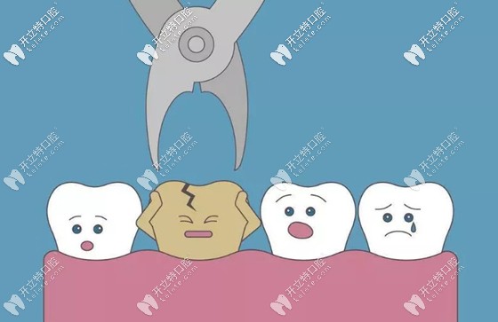 想保护牙齿定期做口腔检查很重要