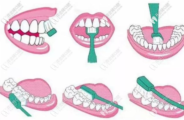 巴氏刷牙法详细图解