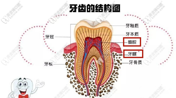 开髓引流术牙神经不在了?不信你看这牙齿开髓引流步骤图