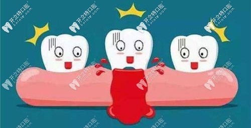 牙龈出血等情况不适合进行牙龈按摩 牙龈出血等情况不适合进行牙龈按摩
