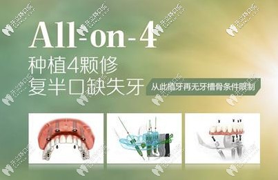 做All-on-4全口种植牙疼么