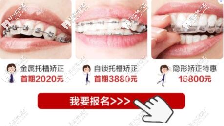 惠州致美口腔学生牙齿矫正优惠