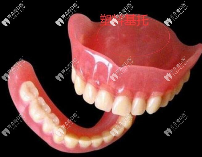 塑料托活动义齿
