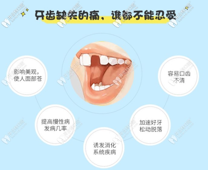 北京奥齿泰全口种植牙得多少钱