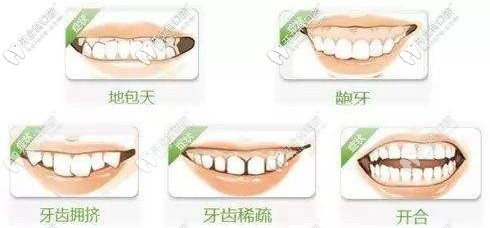 五类人适合做牙齿矫正