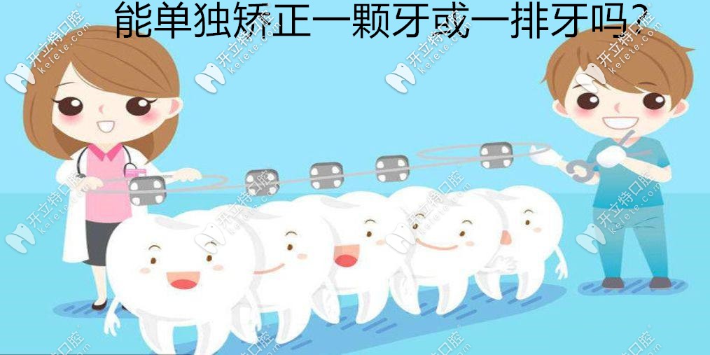​牙齿矫正能单独矫正一颗歪牙或进行一排牙齿正畸吗？