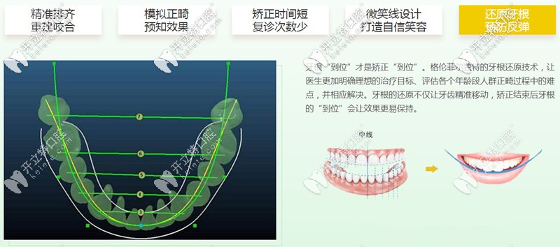 格伦菲尔口腔矫正五大优势 格伦菲尔口腔矫正五大优势