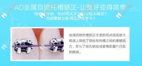 时代天使是什么原理_时代天使(2)