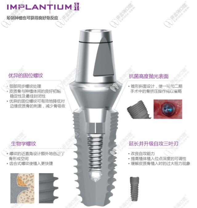 登腾lmplantiumⅡ型号