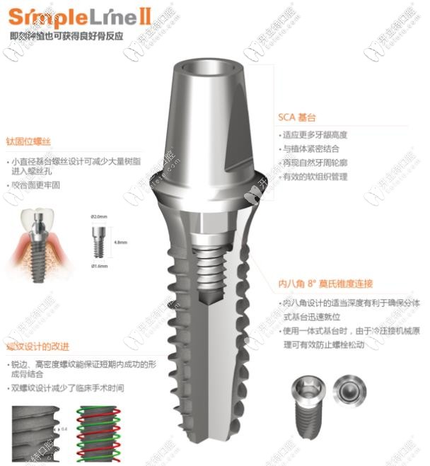 登腾simpleLineⅡ种植体型号