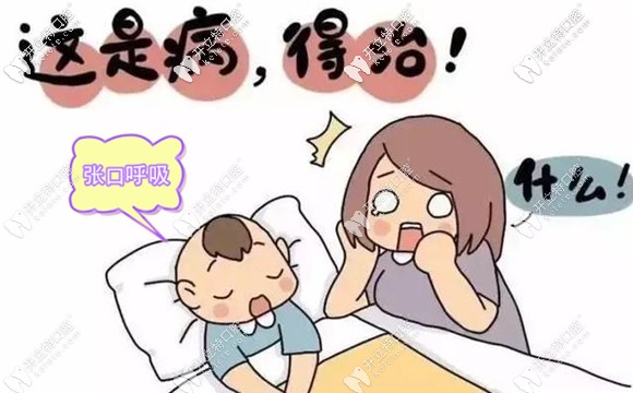 口呼吸会导致牙颌发育不良 口呼吸会导致牙颌发育不良