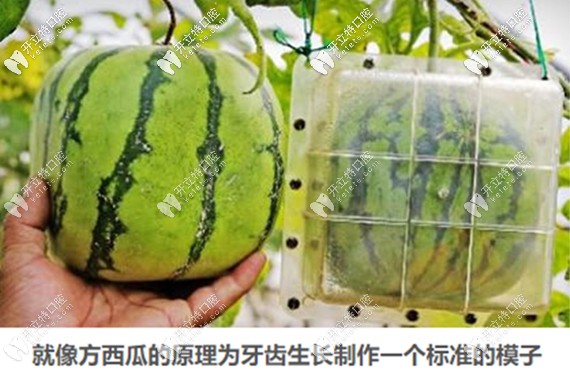 儿童早期牙齿矫正器矫正的原理图 儿童早期牙齿矫正器矫正的原理图
