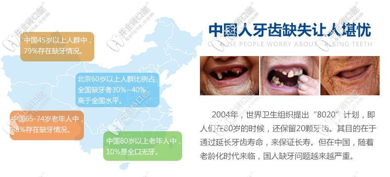 国人的牙齿健康问题需重视 国人的牙齿健康问题需重视
