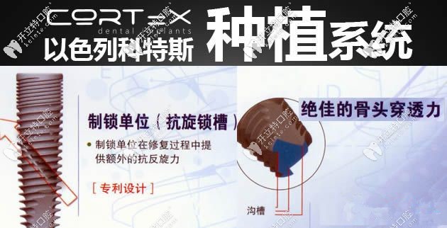 以色列cortex种植体优点