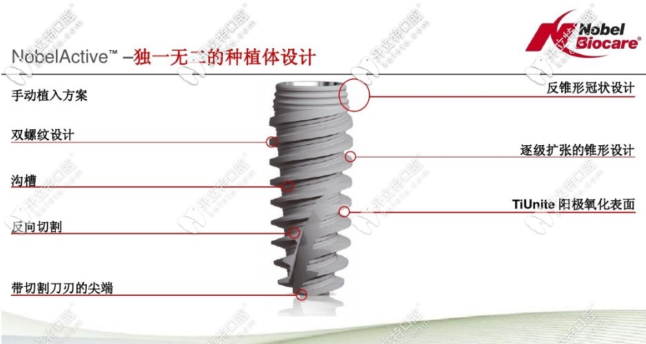 nobelactive种植体的优势