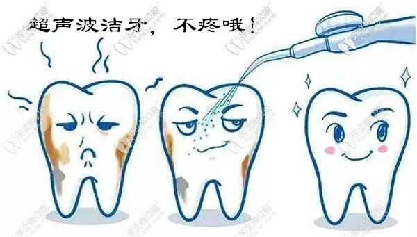 超声波洗牙疼吗