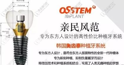 奥齿泰种植体的优势 奥齿泰种植体的优势