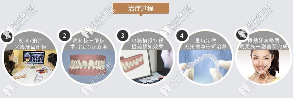 隐形牙齿矫治器矫正过程