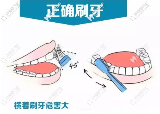 正确的刷牙方法能避免牙齿敏感