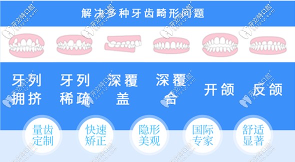 潍坊隐形牙齿矫正价格 潍坊隐形牙齿矫正价格
