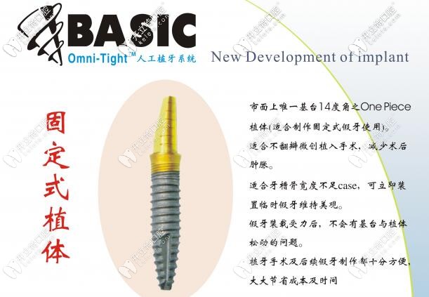 美国Basic固定式植体优势 美国Basic固定式植体优势