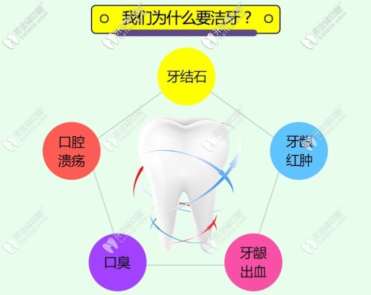 为什么要定期洗牙