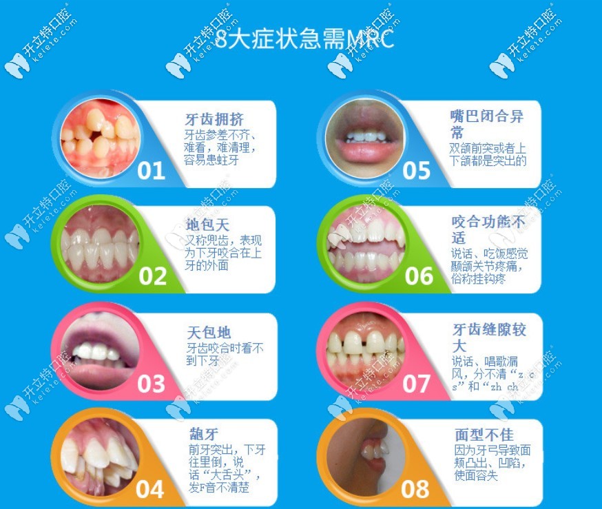 哪些牙齿畸形需要做早期干预矫正