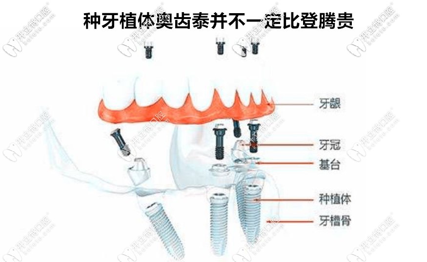 奥齿泰并不一定比登腾贵