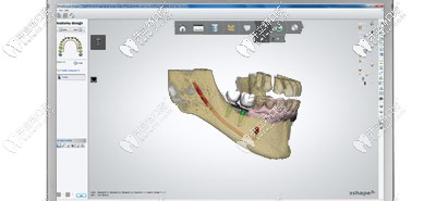 CAD / CAM方案设计