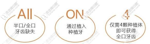 all-on-4种植技术 all-on-4种植技术