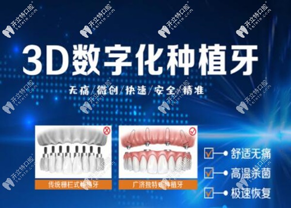 北京优贝口腔3D数字化导板种植技术