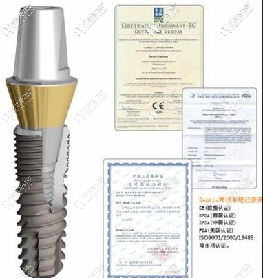 韩国登特斯种植体