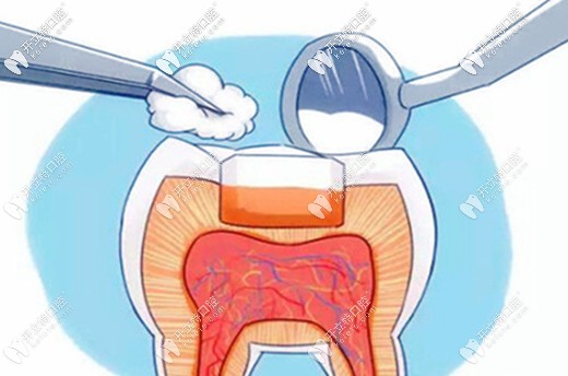 魏文龙医生简介树脂和嵌体补牙的区别